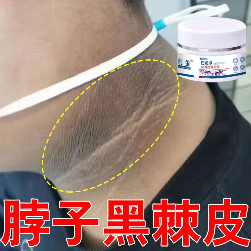 脖子黑色素除黑棘皮颈部白霜淡化身体皮肤黑色沉淀不干净修复神器