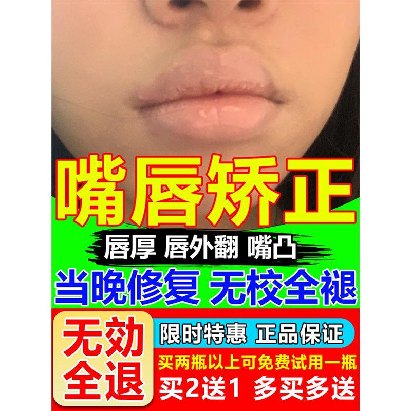 缩小厚嘴唇变薄神器变小外翻矫正改善嘴凸唇周黑黑色素去除闭合贴