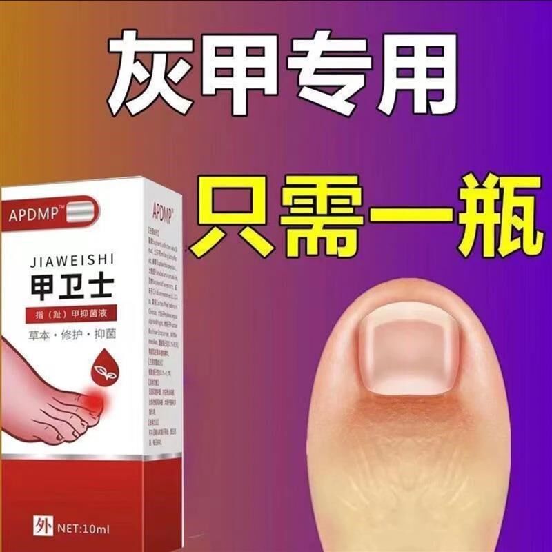 甲卫士专治甲沟炎痛神器肉芽化脓红肿嵌甲走路疼草本镇痛抑菌药水