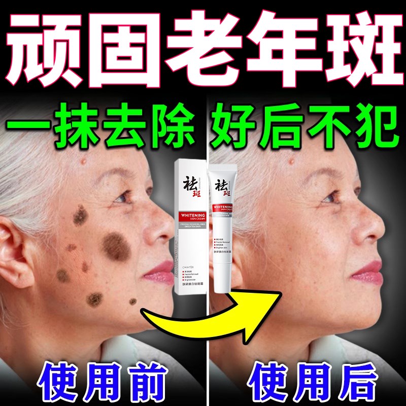 去老年斑强力去除黑色素手脸部专用老人祛斑霜黄褐斑正品淡化色斑