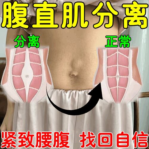 腹直肌分离修复仪训练器收腹带产后肚皮松弛修复锻炼盆底肌收腹贴