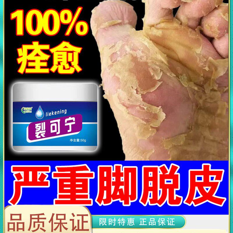 脚底干裂脱皮药膏治脚裂脚后跟干裂脚上起水泡痒粗糙起皮蜕皮专用