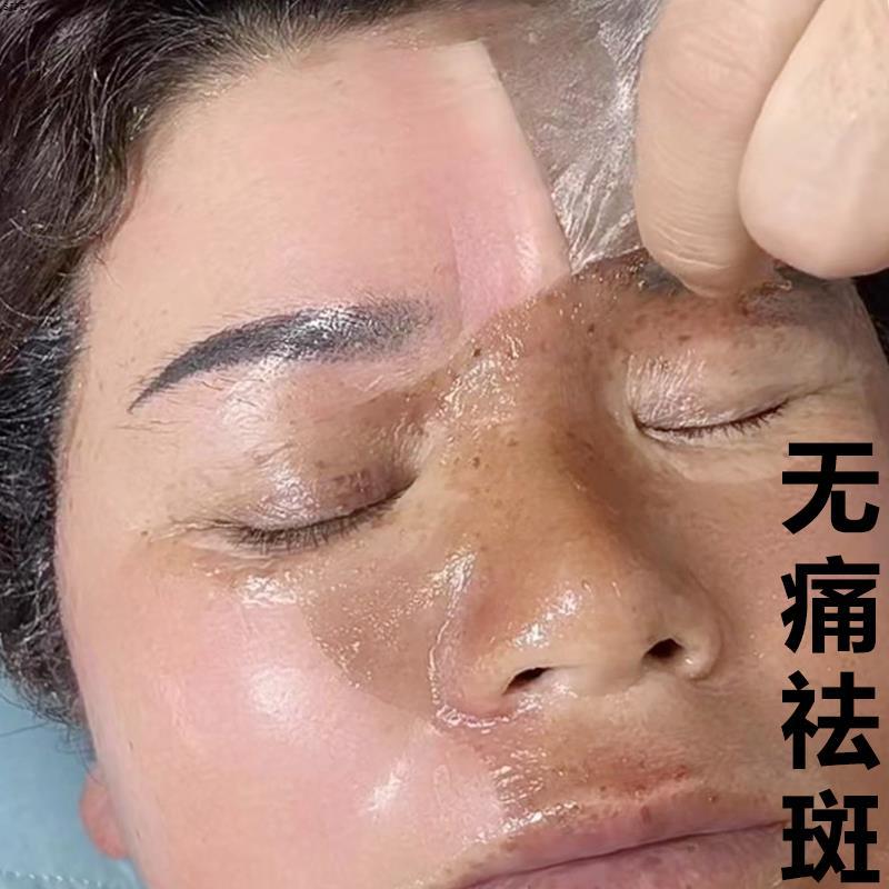 去脸上斑点黑色素 还你嫩白无瑕疵的脸蛋 男女通用 【夏季优选】