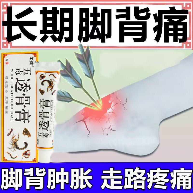 脚背鼓包筋膜疼痛肿痛扭伤僵硬酸痛脚面脚踝腱鞘专用膏贴脚底疼