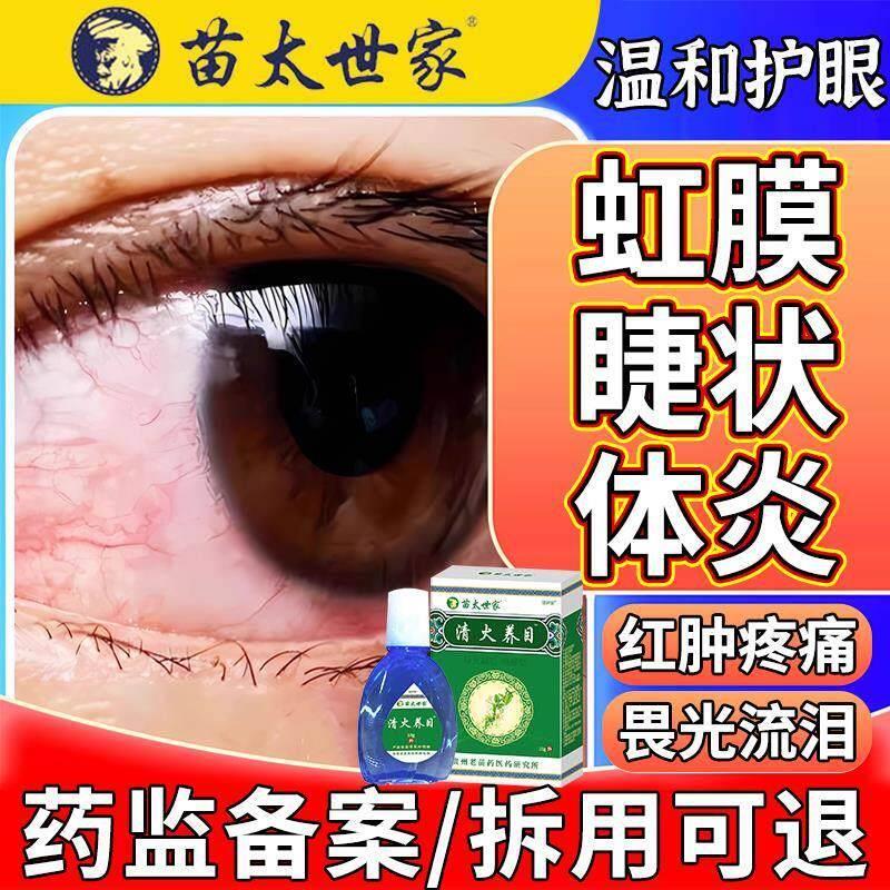 虹膜炎睫状体炎专滴用眼液眼睛红肿肿痛红膜可搭的眼水用EM