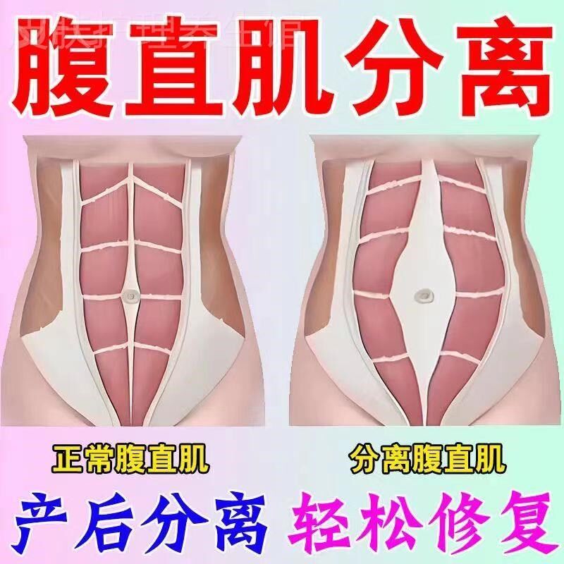 腹直肌分离修复贴产后家用仪器古法训练锻炼小肚子松弛修复药膏贴
