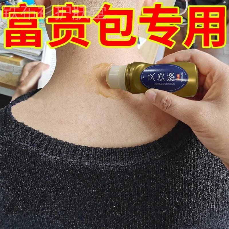 【一盒就够】富贵包消了颈椎痛富贵包消除贴正品疏通颈椎鼓包神器
