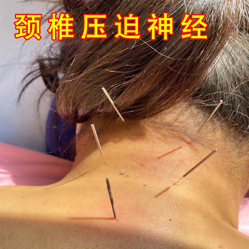 【200%全俞】颈压迫椎神经缓头晕解头脖子疼僵硬手颈麻椎特校贴膏