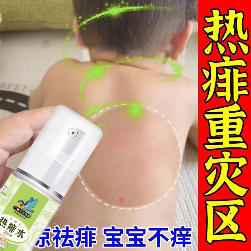 成人痱子水祛痱止痒专用热痱水去痱子喷雾大人痱子粉露热痱子神器