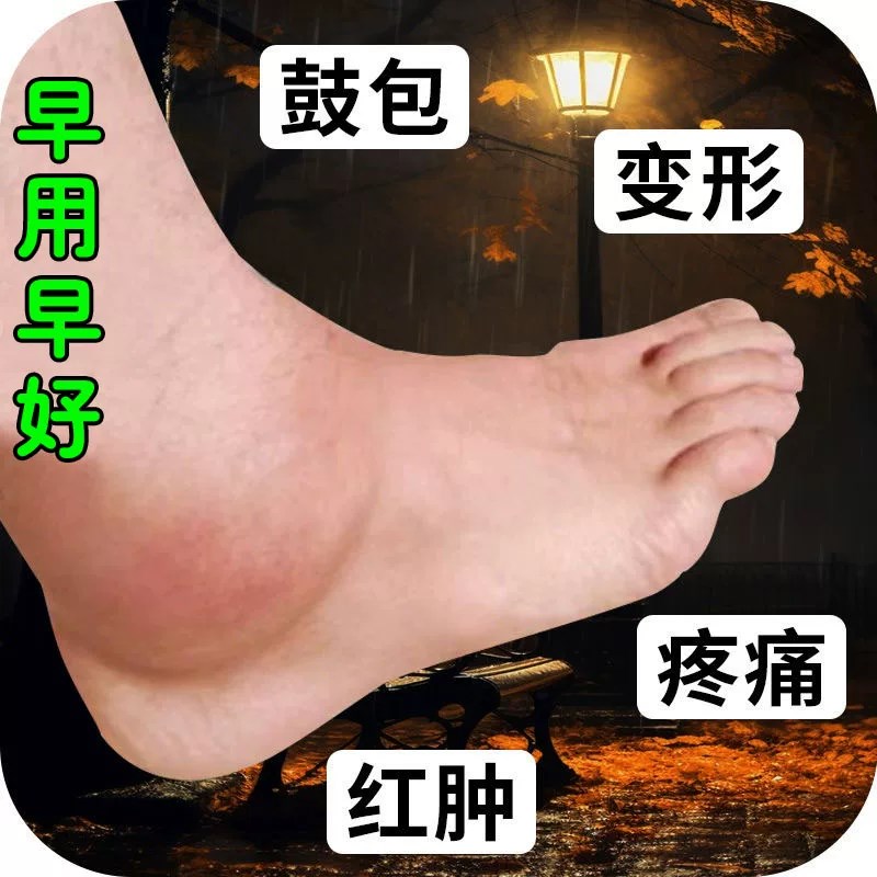 下肢水肿喷雾肖腿脚肿老人水肿全身水肿脸部水肿穿鞋困难肖肿用