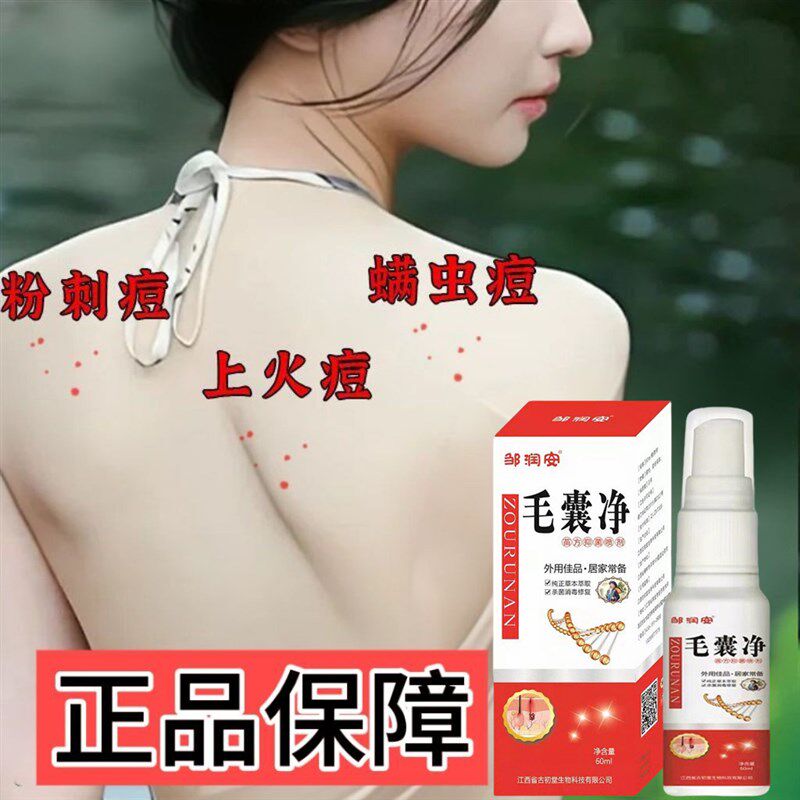 【背痘买他】身体祛痘喷雾快速改善淡化痘印粉刺背部抗痘男女通用