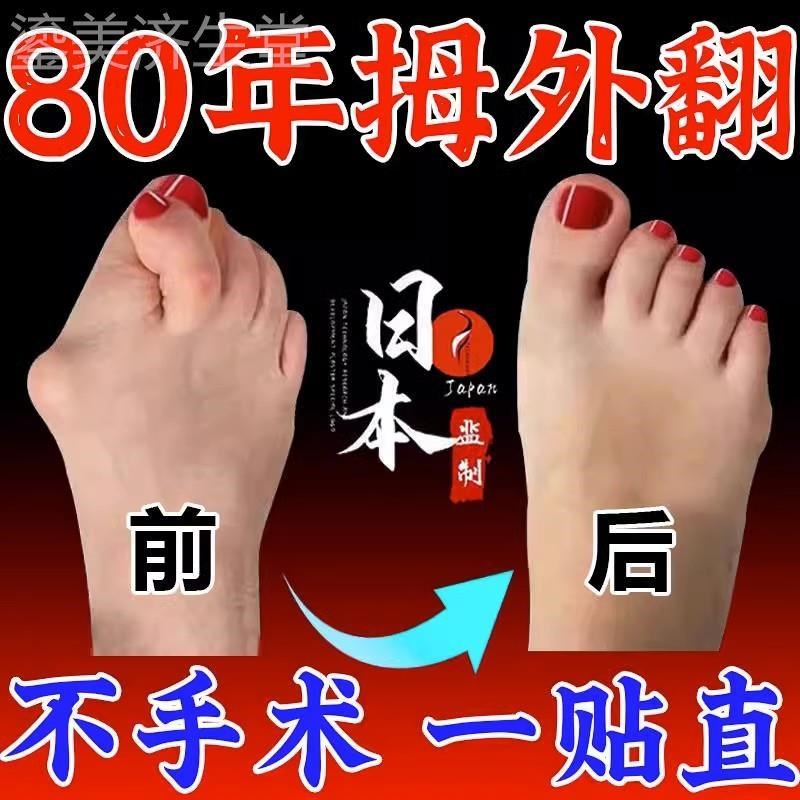 拇指外翻贴脚趾矫正器分大母脚趾头纠正母外翻软胶贴膏矫正贴