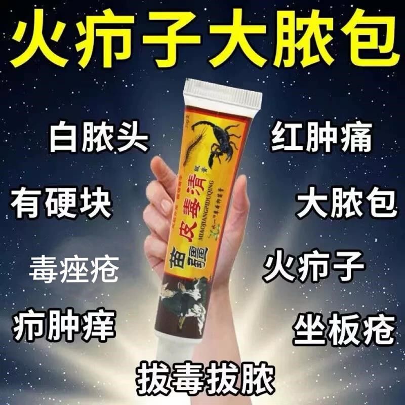 苗疆火疖子拔脓拔毒膏 屁股长痤疮硬块坐板疮红肿大脓包脸部痘痘