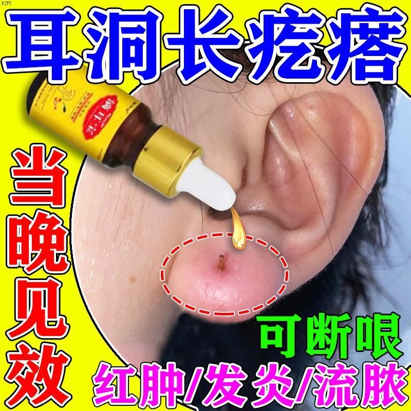 耳洞增生疤痕疙瘩凸起肉球疙瘩防止红肿发炎耳洞清洁专用护理液