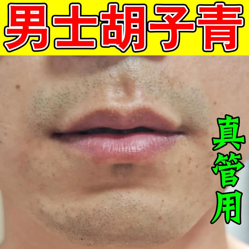 胡青去除络腮胡子淡化男士黑印专用去除胡青软化唇毛胡须抑制生长