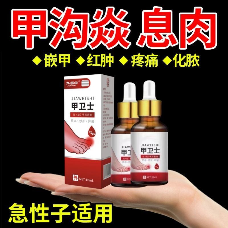 【严重甲沟炎专用】去肉芽脚趾甲往肉里长嵌甲红肿疼痛化脓抑菌液
