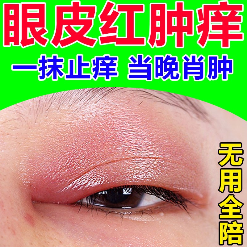 眼皮红肿痒杀菌止痒眼睛周围过敏发痒干涩板腺疏通消除散粒肿眼膏