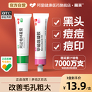 丽芙阿达帕林凝胶祛痘医用药膏粉刺汗腺皮脂正品 印药痤疮软膏官方