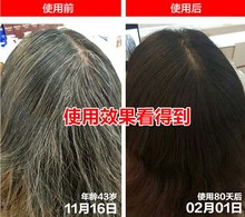滋养女男控油何首乌洗发露育发液1