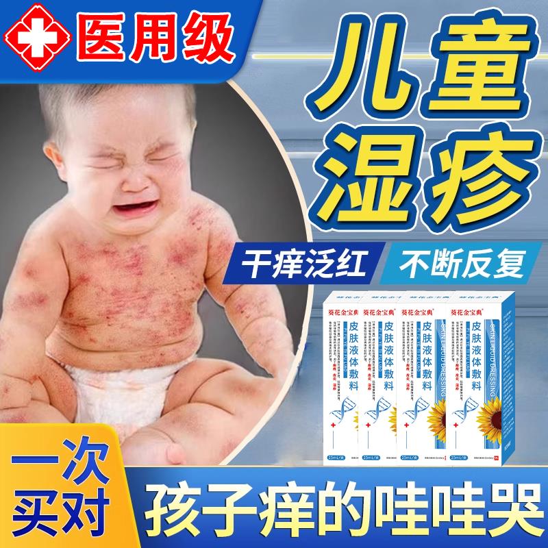 儿童特应性皮炎除湿止痒膏