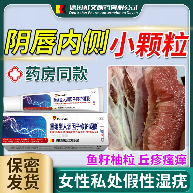 女性假性尖锐湿疣下面长小疙瘩去除止痒膏阴道外阴阴唇私处瘙痒WQ