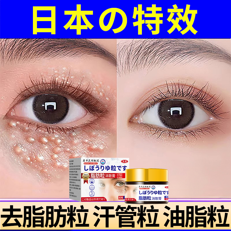 去脂肪粒汗管眼部除神器用