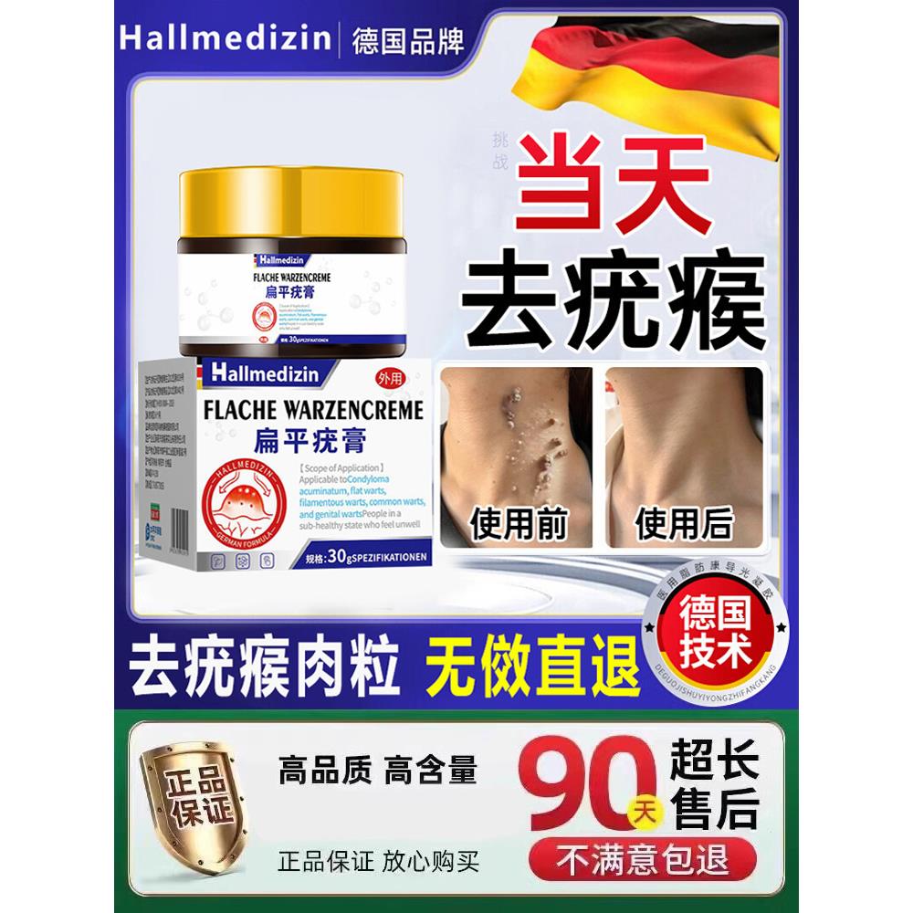 去疣瘊小肉粒除膏猴子里疙