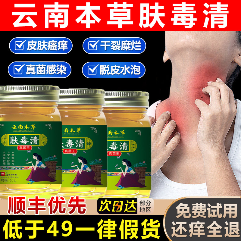 云南本草肤毒清止痒药膏皮