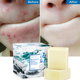 Sea Acne Salt Cleaner 3PCS Pores Soap Removal 3件