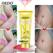 Remove Skin Stretch Cream Rose Body Marks Maternity Repair