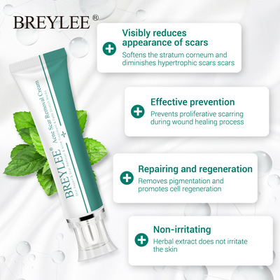 BREYLEE Remove scars Pregnant woman Stretch marks Care cream