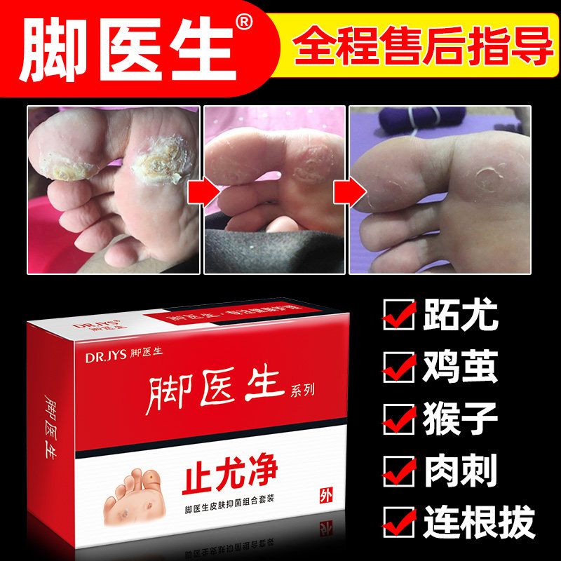 脚医生止尤净跖疣膏贴肉刺根去除刺猴专用鸡眼药足部瘊去疣灵正品