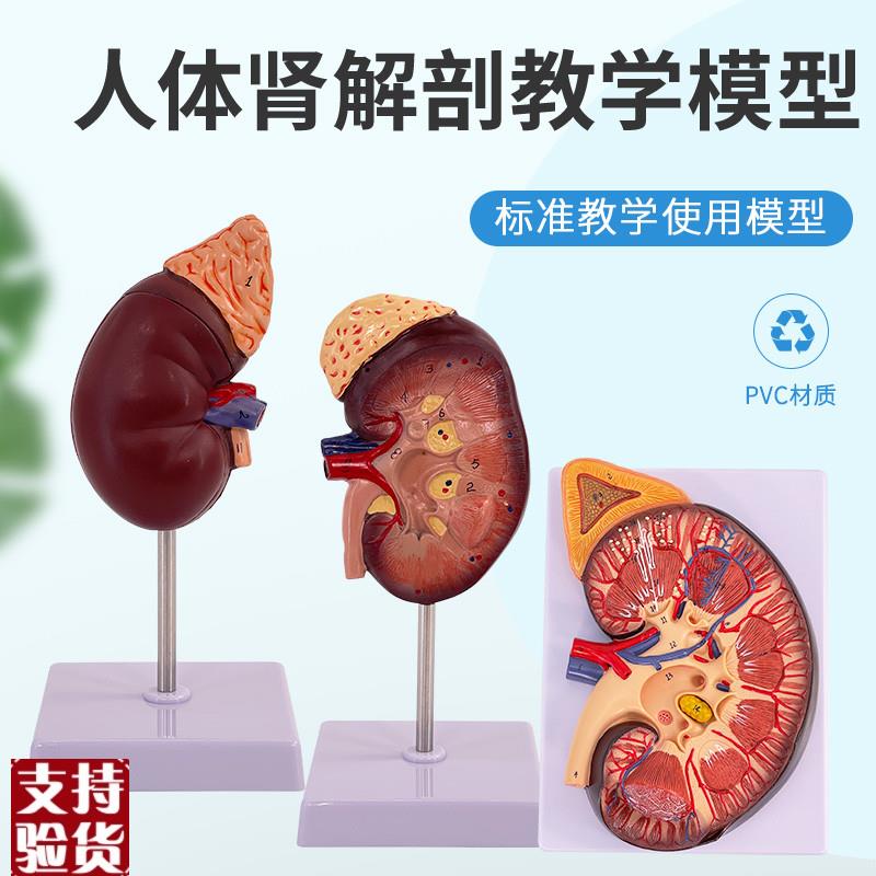 人体肾脏模型肾解剖附肾上腺放大模型病K变肾脏内脏器官解剖3倍