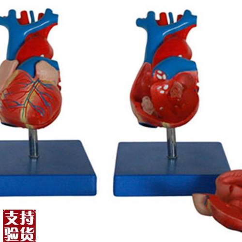 新型自然大I心脏解剖模型