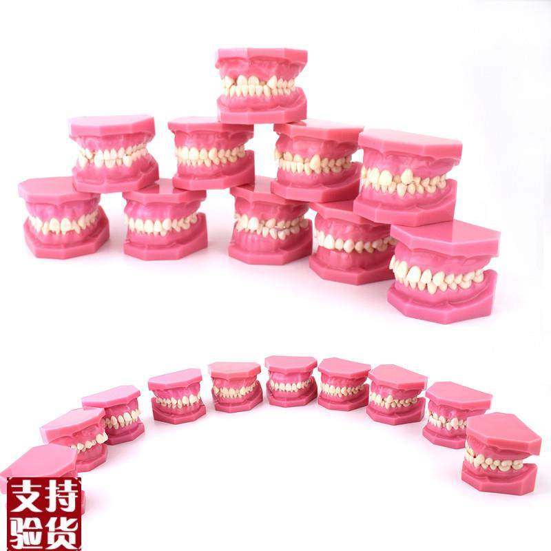 ENOVOd颐诺安氏错颌分类模型ANGEL分类错颌畸形分类演示模型口腔,文具电教/文化用品/商务用品,教学标本/模型,淘宝优惠券,粉丝福利购,淘宝优惠卷