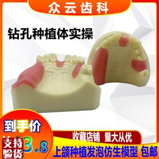 牙科上颌窦提升操练模型种植牙练习模型口腔种植V软牙龈齿科材料