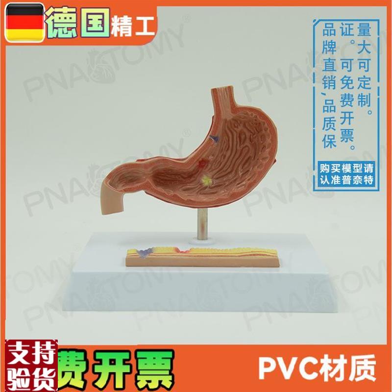 仿真人体b胃解剖病理胃胃穿教学消化系统消化科标本