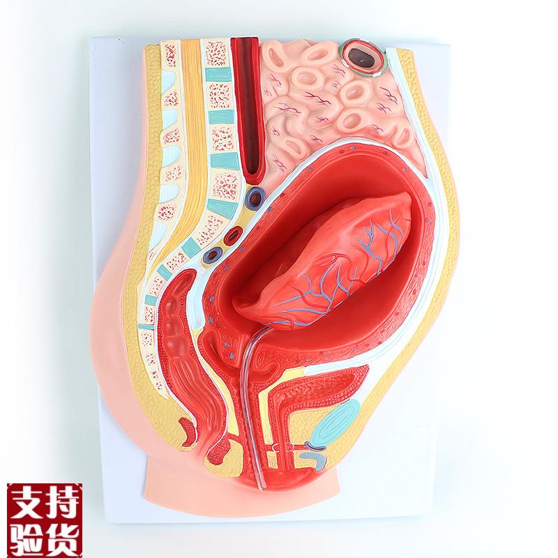 ENOVO颐诺胎盘剥离模型模型组织胚胎胎儿妇产科M教学placenta培训