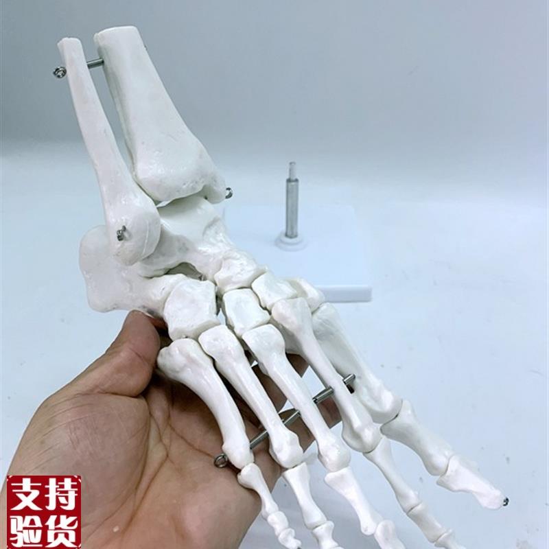 人体医学11踝i关节模型足关节脚关节手足外科胫腓骨下端距骨体