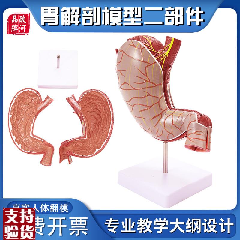 政河病理胃模型人体n胃的穿孔病态胃模消化科胃冠状剖面解剖放大