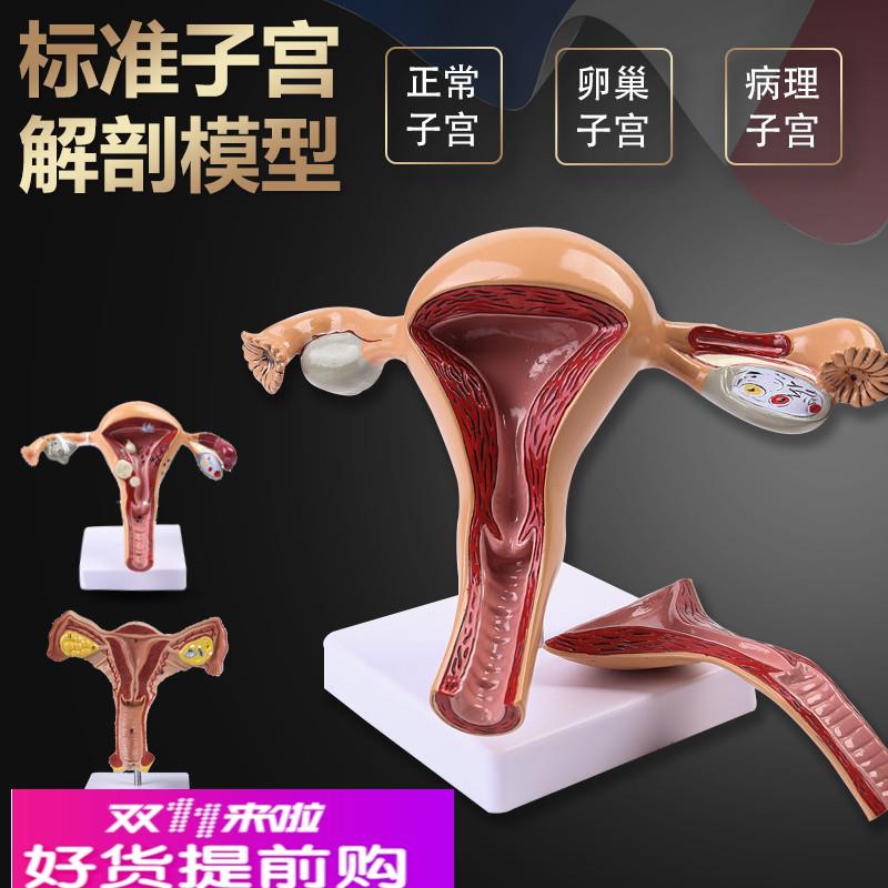人体模型女性生殖子宫模型医院用病变子宫模型教具妇科解剖卵巢