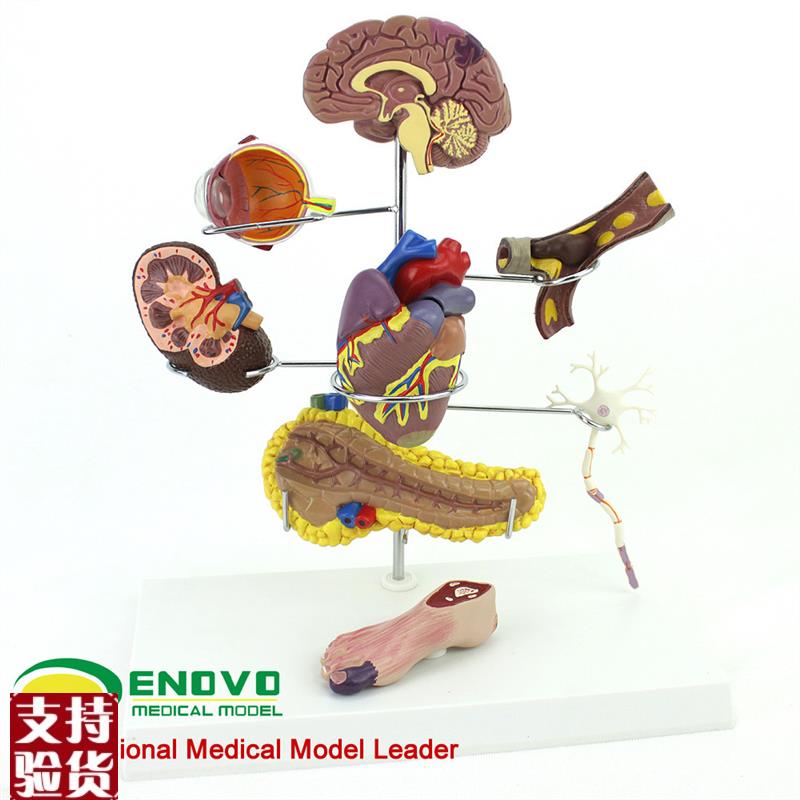 ENOVO颐诺人体医学糖尿u病模型糖尿病并发症大脑心脏胰腺神经元足