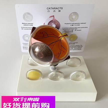 白内障眼睛模型晶片虹膜器官解剖光学教仪医用医学教学教具包邮
