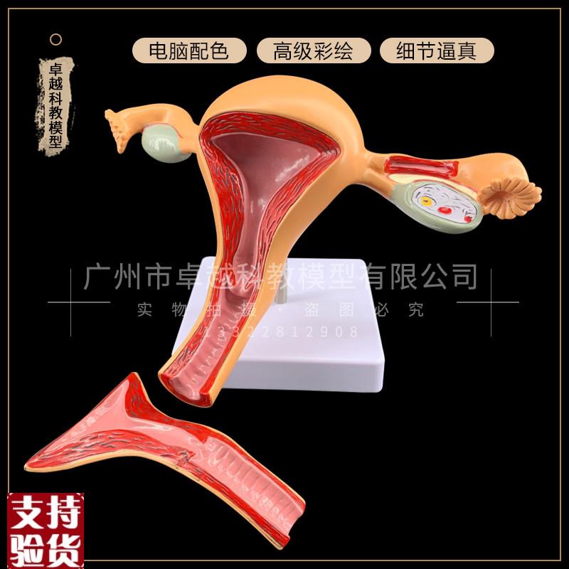 正常子宫模型卵巢病理病变模型生殖科女O性子宫阴道模型包邮