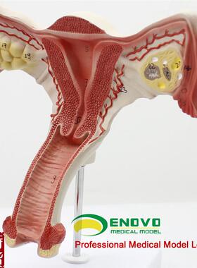 颐诺正品人体医用女性子s宫模型卵巢生殖结构解剖模型妇科妇产科