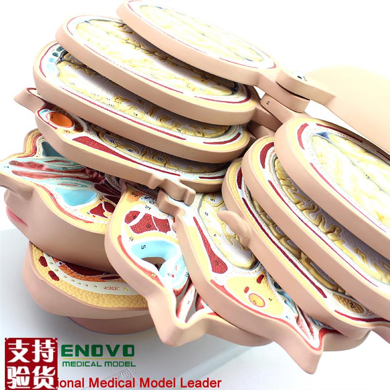 颐诺正品医用人体头颅脑模型脑CTMRI大脑O模型影像放射学神经科