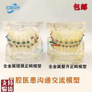 牙科模型正畸结扎m丝托槽口腔教学模型牙齿错颌矫正展示透明牙模