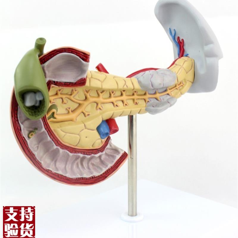 ENOVO颐诺i医学用胰腺十二指肠和胆囊病理模型消化系统消化科模型