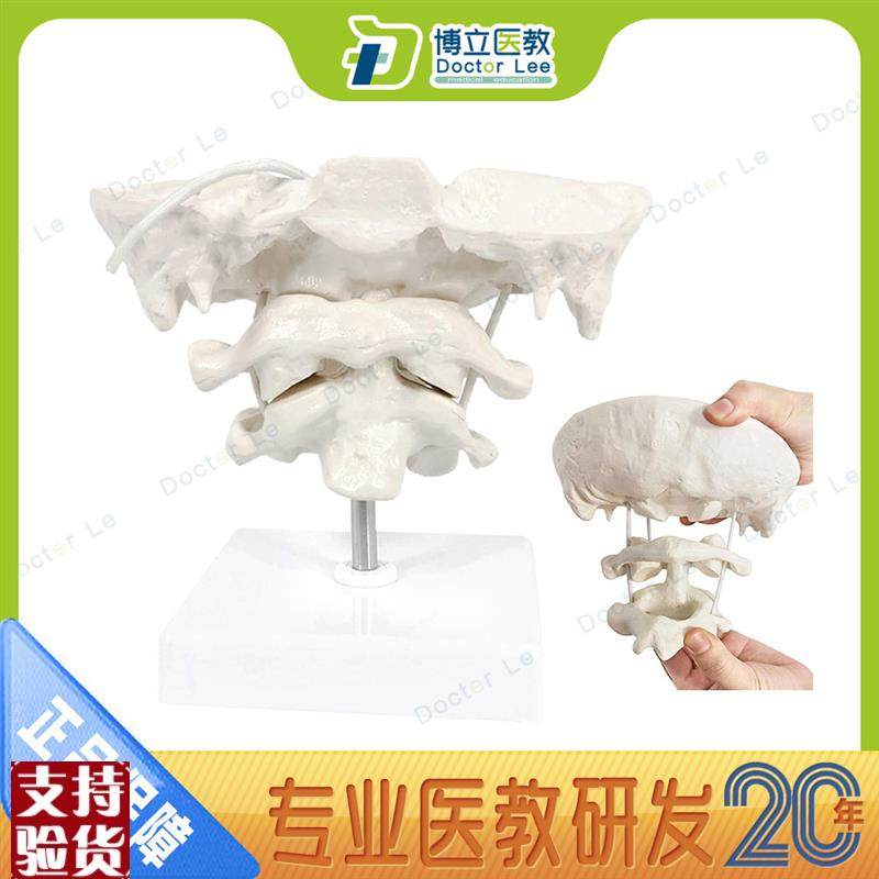 枕骨带寰椎枢椎模型颈椎模型骨骼标本仿真正骨可活Z动枕骨模型