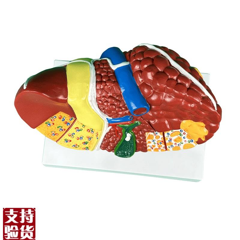 人体肝脏解剖模型肝脏结构模型仿真肝胆胰脾肾心脏Z血管内科学